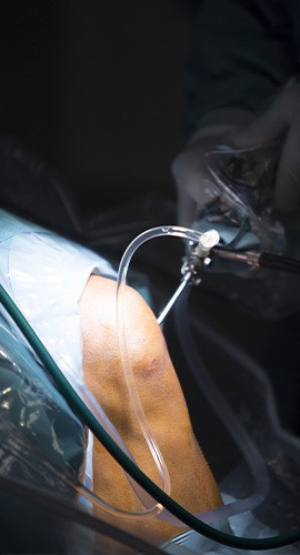 Is Surgery a Difficult Decision? These 5 Facts Will Make It Easier!